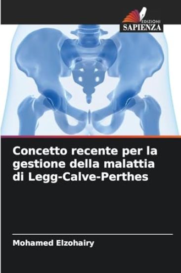Concetto recente per la gestione della malattia di Legg-Calve-Perthes