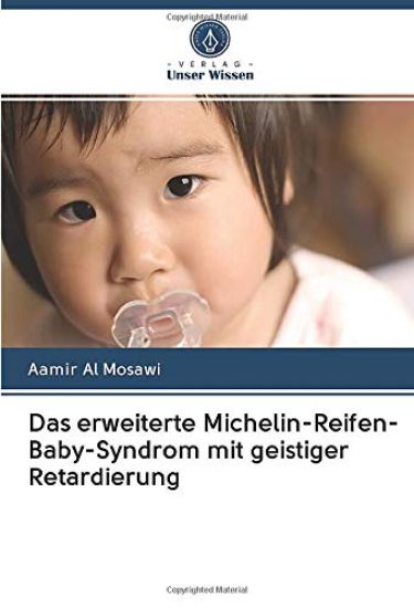 Das erweiterte Michelin-Reifen-Baby-Syndrom mit geistiger Retardierung