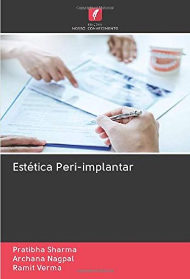Estética Peri-implantar
