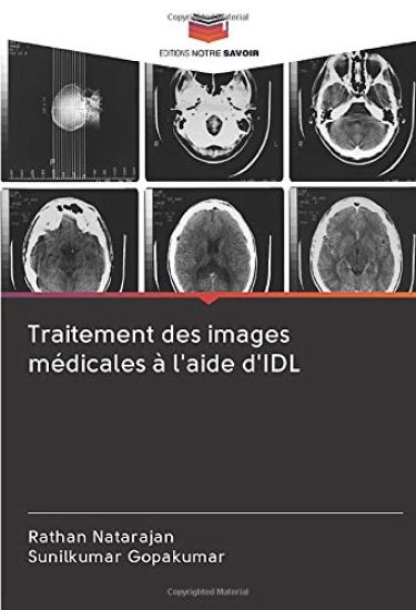 Traitement des images médicales à l'aide d'IDL