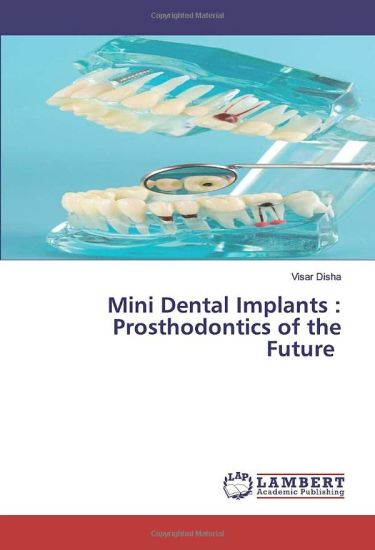 Mini Dental Implants : Prosthodontics of the Future
