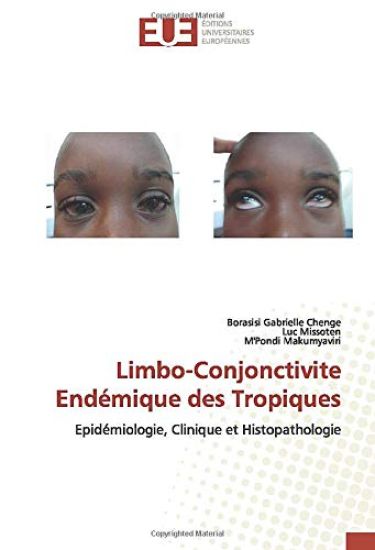 Limbo-Conjonctivite Endémique des Tropiques