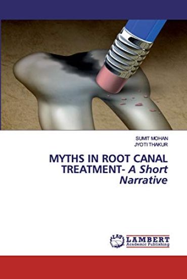 Myths in Root Canal Treatment - A Short Narrative