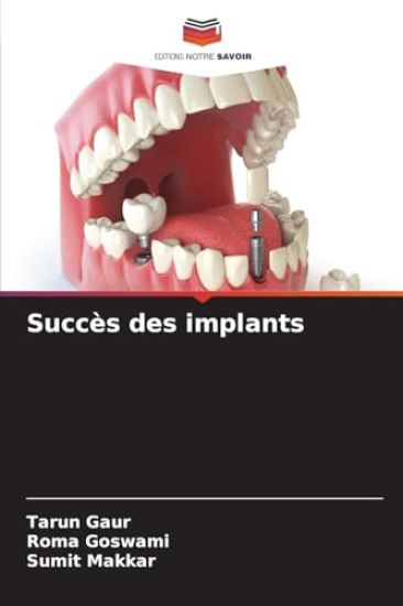 Succès des implants