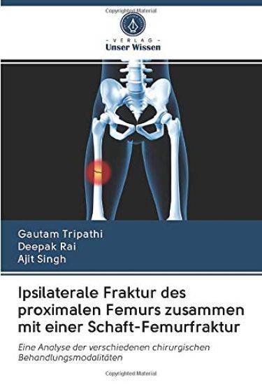 Ipsilaterale Fraktur des proximalen Femurs zusammen mit einer Schaft-Femurfraktur