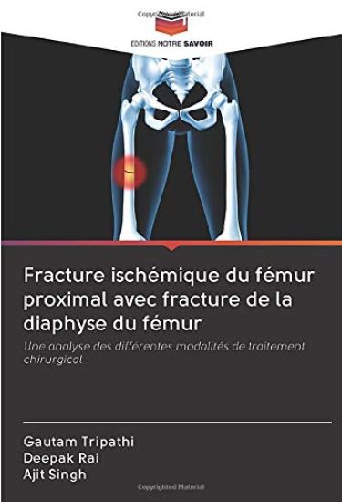 Fracture ischémique du fémur proximal avec fracture de la diaphyse du fémur
