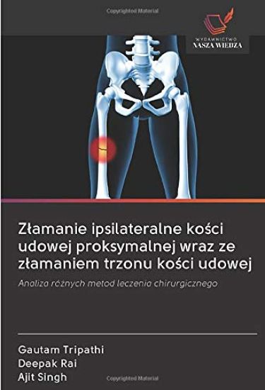 Z¿amanie ipsilateralne ko¿ci udowej proksymalnej wraz ze z¿amaniem trzonu ko¿ci udowej