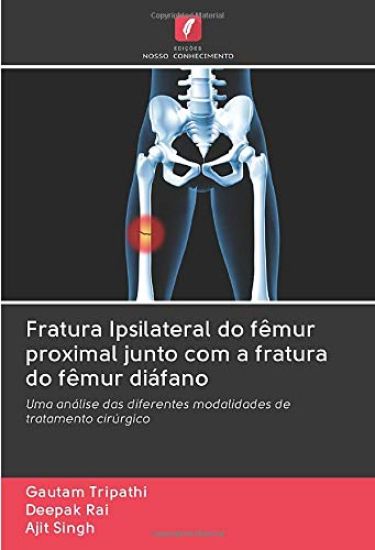 Fratura Ipsilateral do fêmur proximal junto com a fratura do fêmur diáfano