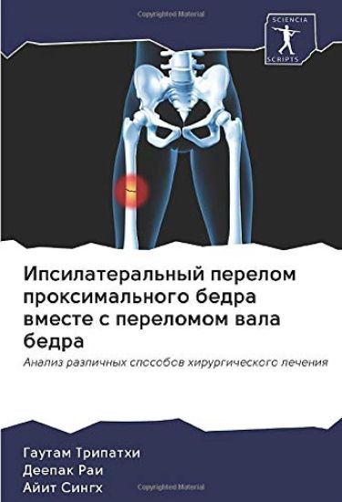 Ipsilateral'nyj perelom proximal'nogo bedra wmeste s perelomom wala bedra