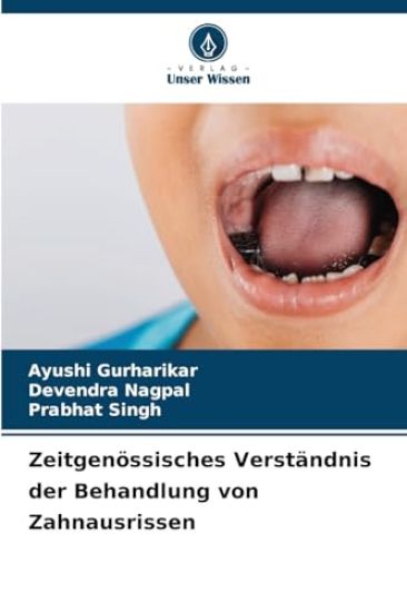 Zeitgenössisches Verständnis der Behandlung von Zahnausrissen