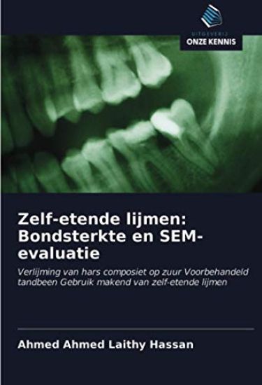 Zelf-etende lijmen: Bondsterkte en SEM-evaluatie