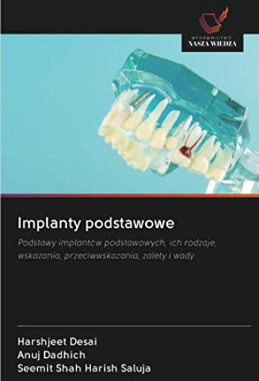 Implanty podstawowe