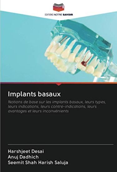 Implants basaux