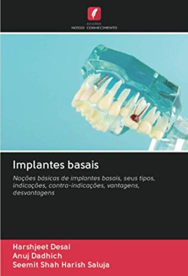 Implantes basais