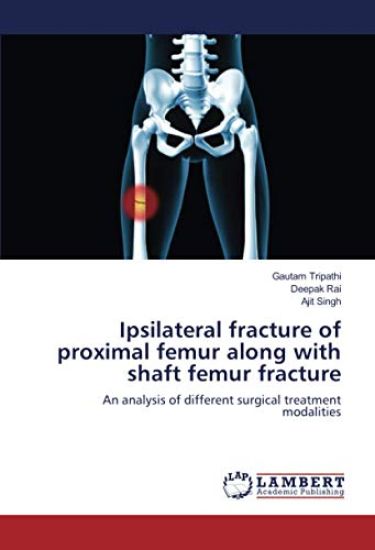 Ipsilateral fracture of proximal femur along with shaft femur fracture