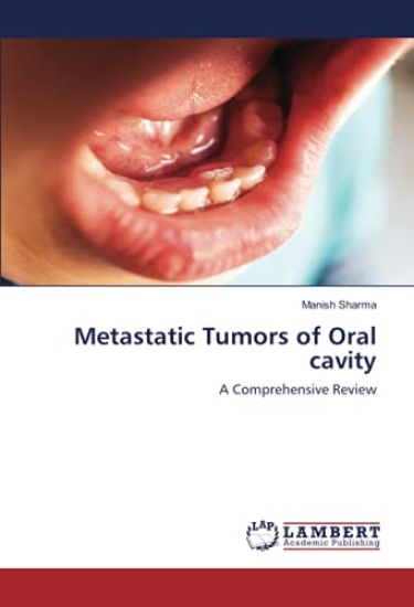 Metastatic Tumors of Oral cavity