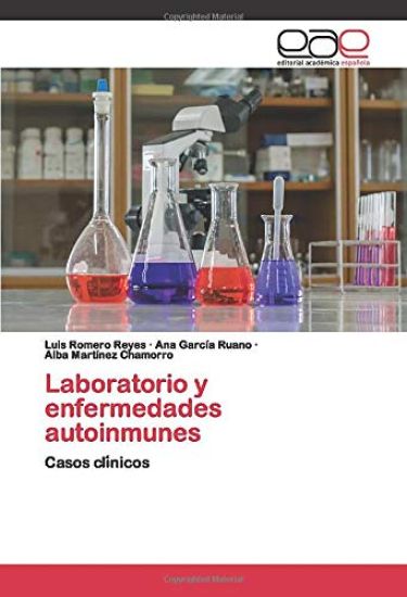 Laboratorio y enfermedades autoinmunes