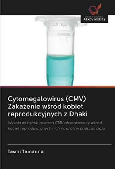 Cytomegalowirus (CMV) Zaka¿enie w¿ród kobiet reprodukcyjnych z Dhaki