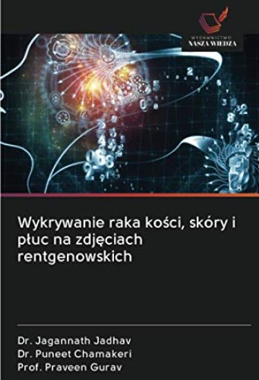 Wykrywanie raka ko¿ci, skóry i p¿uc na zdj¿ciach rentgenowskich