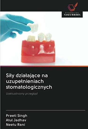 Sily dzialające na uzupelnieniach stomatologicznych