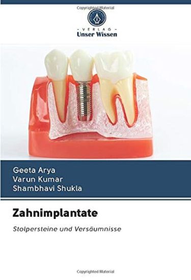 Zahnimplantate
