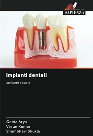 Impianti dentali