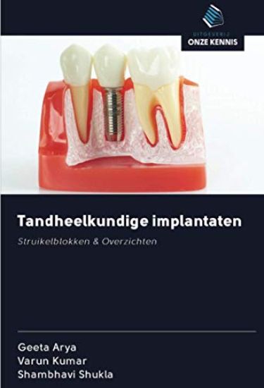 Tandheelkundige implantaten