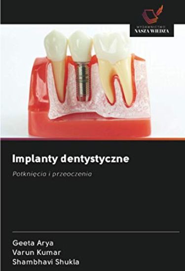 Implanty dentystyczne