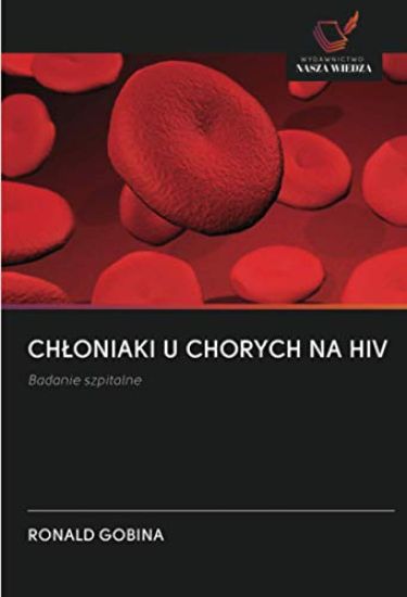 CH¿ONIAKI U CHORYCH NA HIV