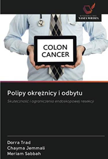 Polipy okr¿¿nicy i odbytu