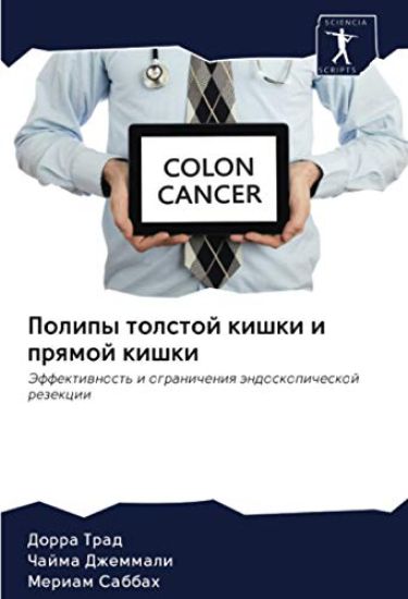 Polipy tolstoj kishki i prqmoj kishki