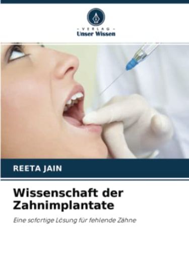 Wissenschaft der Zahnimplantate