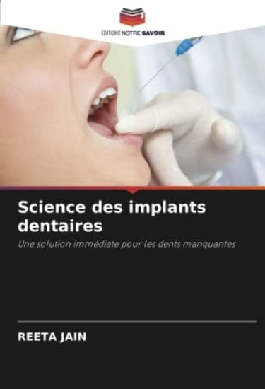 Science des implants dentaires