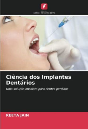 Ciência dos Implantes Dentários
