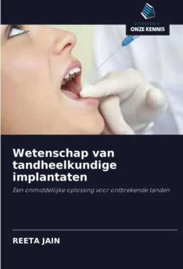 Wetenschap van tandheelkundige implantaten