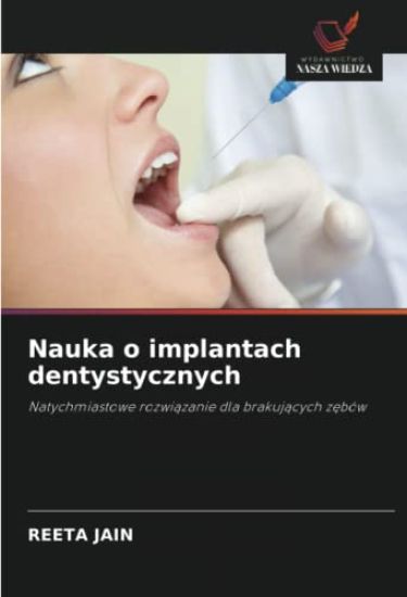 Nauka o implantach dentystycznych