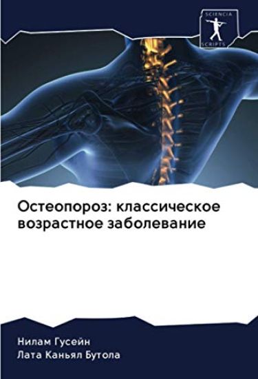 Osteoporoz: klassicheskoe wozrastnoe zabolewanie
