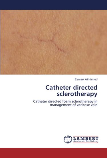 Catheter directed sclerotherapy