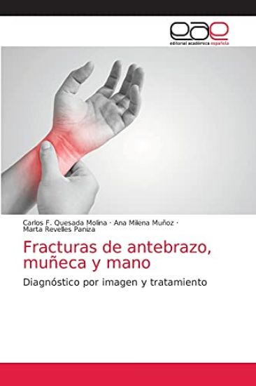 Fracturas de antebrazo, muñeca y mano