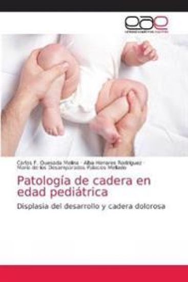 Patología de cadera en edad pediátrica