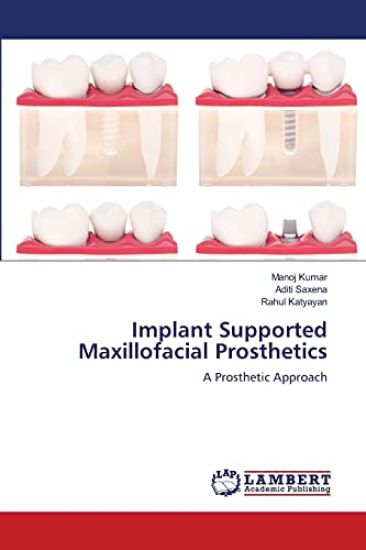 Implant Supported Maxillofacial Prosthetics