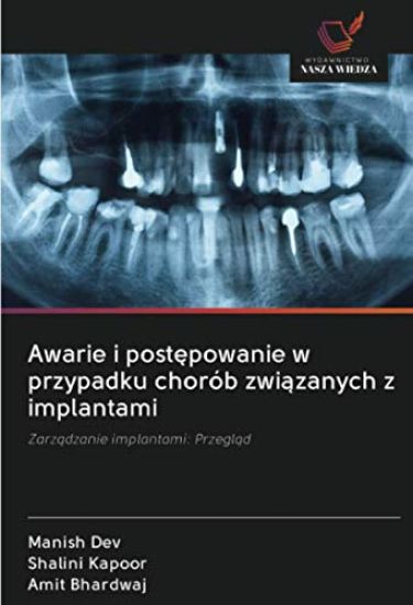 Awarie i post¿powanie w przypadku chorób zwi¿zanych z implantami