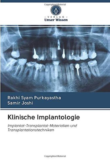 Klinische Implantologie