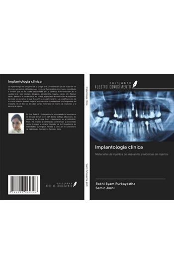 Implantología clínica