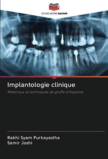 Implantologie clinique
