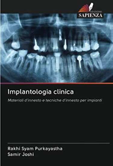 Implantologia clinica
