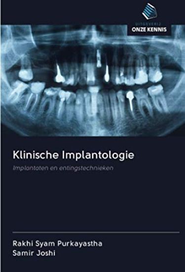 Klinische Implantologie