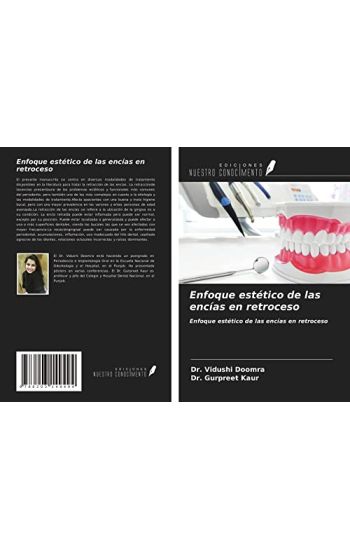 Enfoque estético de las encías en retroceso