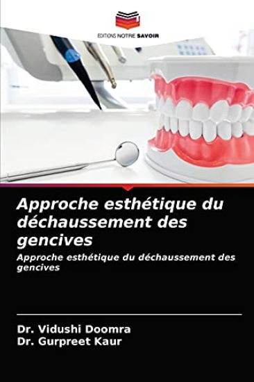 Approche esthétique du déchaussement des gencives