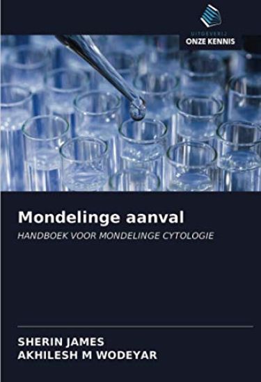 Mondelinge aanval